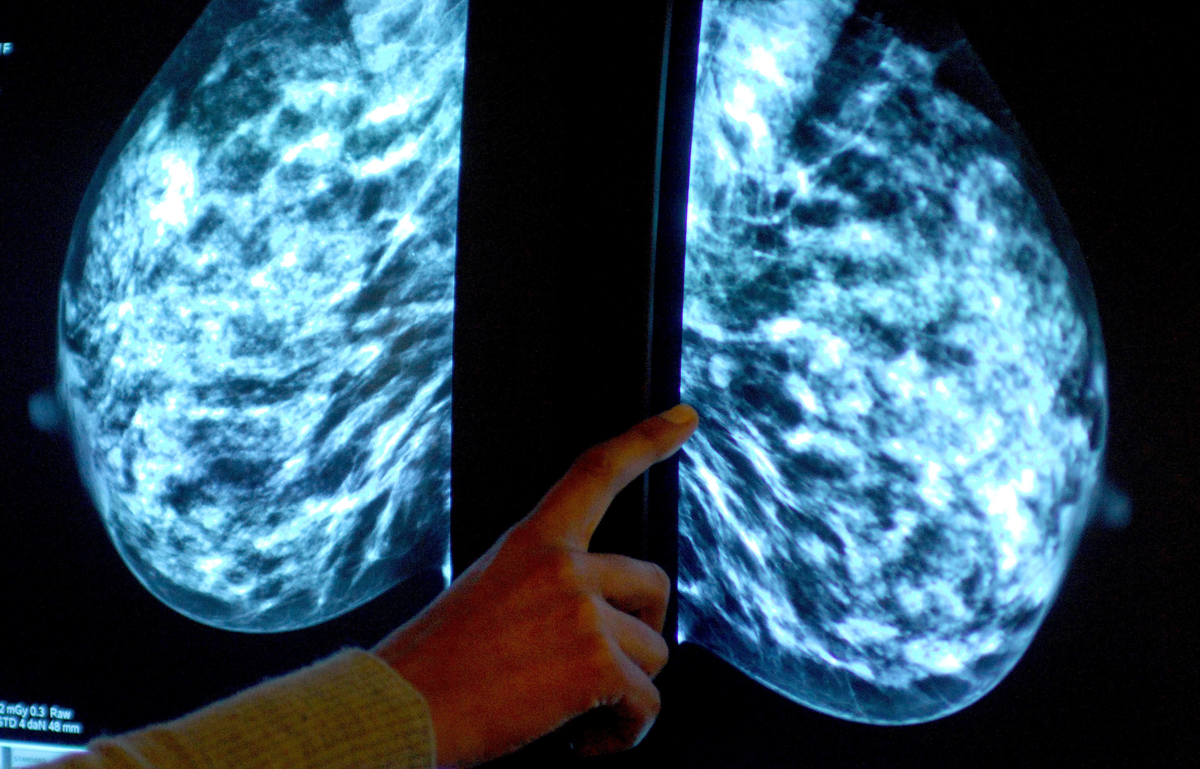 Breast screening uptake in east Berkshire, north east Hampshire, Farnham and Surrey Heath remains below pre-pandemic levels
