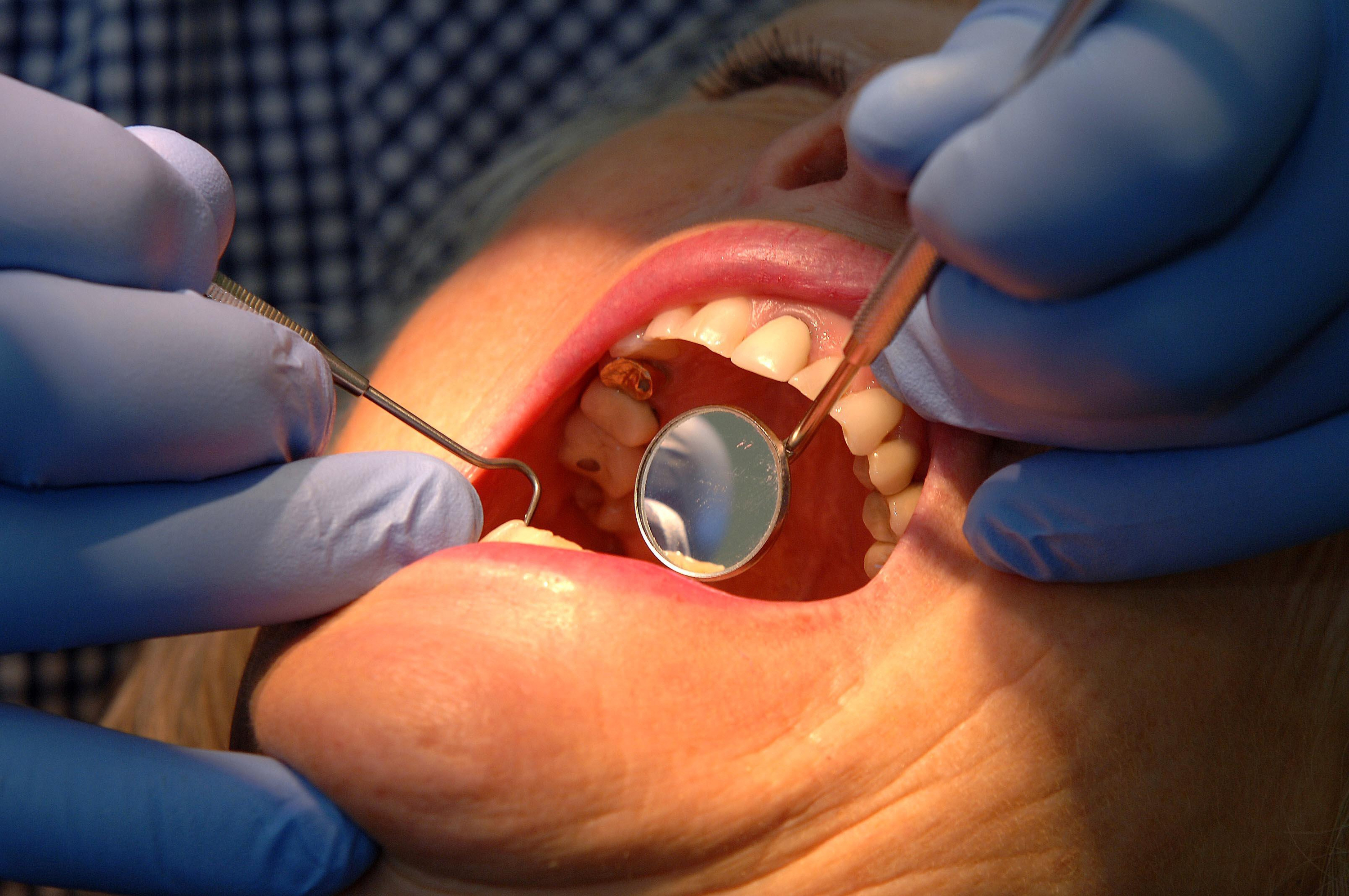  Frimley and the surrounding areas among areas with best access to NHS dentists – as 'postcode lottery' sees thousands miss out
