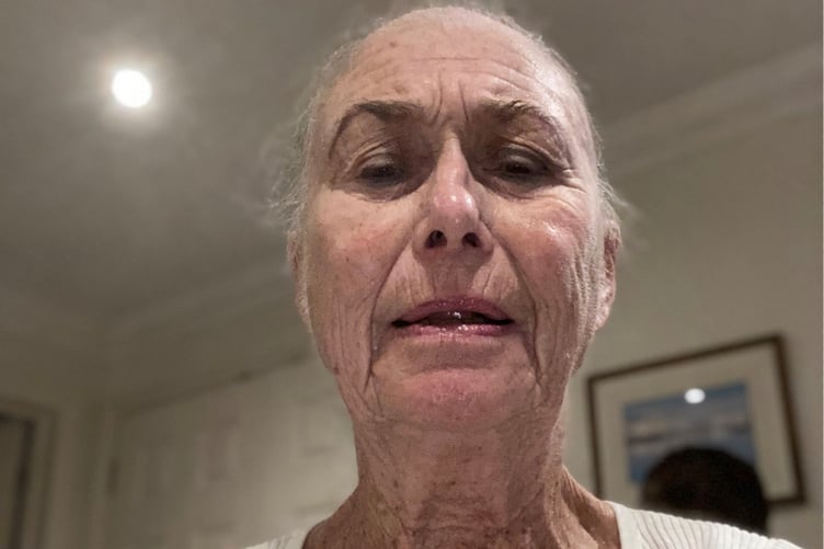 Catriona Tremlett after having chemotherapy.