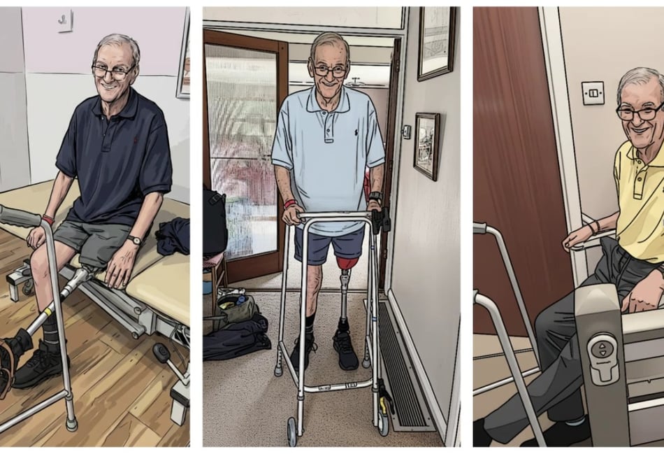 Daughter warns of ‘fragmented’ NHS care after dad loses leg