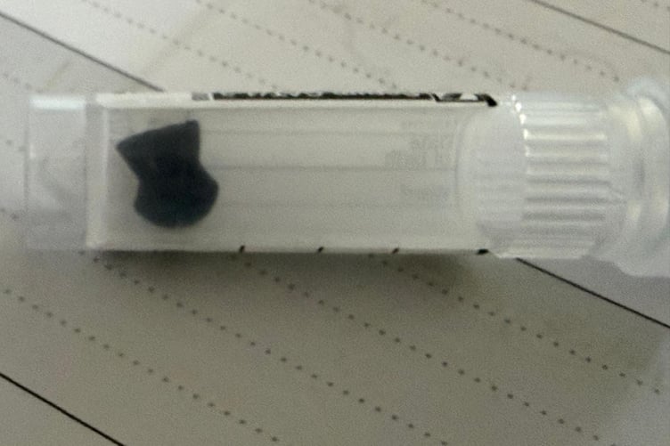 The air gun pellet removed from Henry's head.